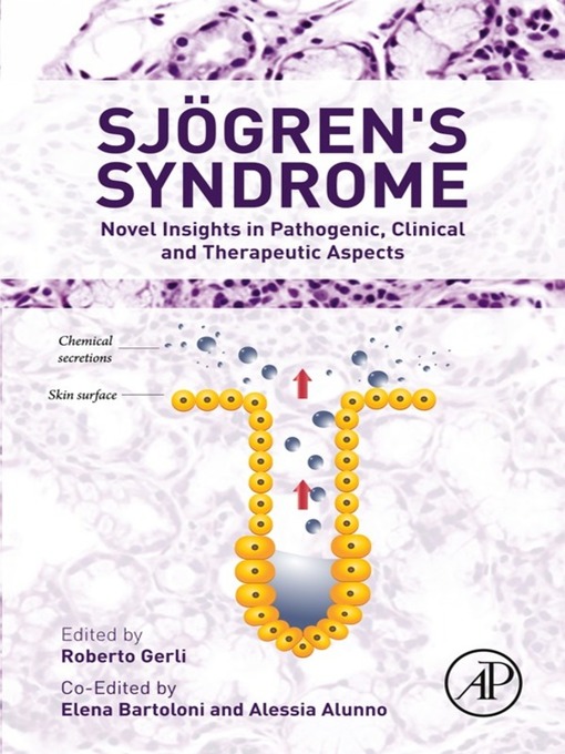 Title details for Sjogren's Syndrome by Alessia Alunno - Available